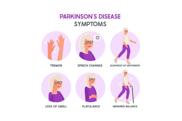 Parkinson s Disease Symptoms - Chart Crafts